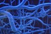 Imágen de células nerviosas, alzheimer