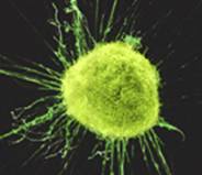 Foto de Célula de cáncer infantil