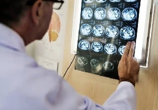 Un médico revisa  una radiografía, como medida de prevención de enfermedades neurológicas 
