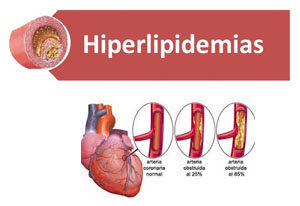 hiperlipidemias trastornos metabolismo lipidos