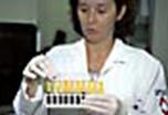 Mujer con muestras de sangre para detectar la poliomielitis