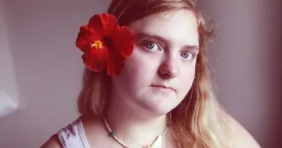 chica con discapacidad intelectual con una flor en el pelo