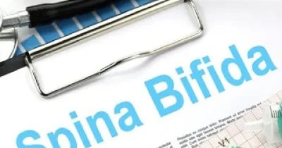 Banner sobre Día Internacional de la Espina Bífida (Fuente: El Debate/Salud+Bienestar)