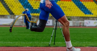 Atleta paralímpico corre en una pista con prótesis | Foto de 123.RF/StotPoint74