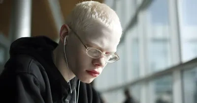Joven estudiante con albinismo y gafas para corrección de la vista