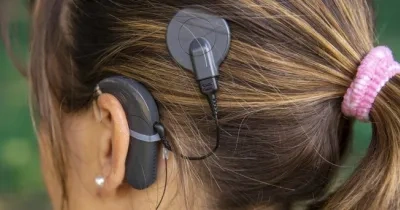Una mujer con audífono de implante coclear