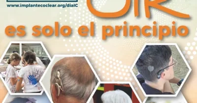 cartel del dia del implante coclear. aparecen fotos de cabezas de personas con implantes.