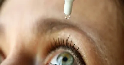 Una persona que sufre el síndrome de ojo seco utilizando lágrimas artificiales (Fuente: Clínica Baviera)