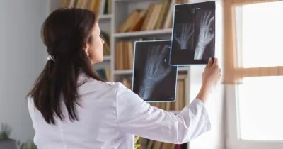 Una especialista consulta unas radiografías