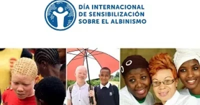 Banner del Día Internacional de Sensibilización sobre el Albinismo 2023 (Fuente: Oficina del Alto Comisionado de las Naciones Unidas para los Derechos Humanos - ACNUDH)
