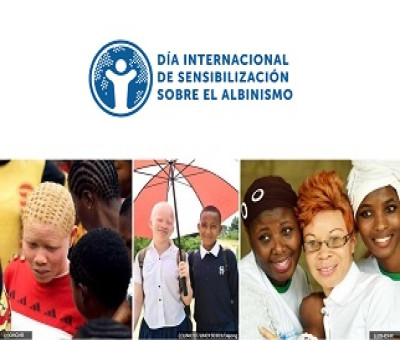 Banner del Día Internacional de Sensibilización sobre el Albinismo 2023 (Fuente: Oficina del Alto Comisionado de las Naciones Unidas para los Derechos Humanos - ACNUDH)