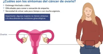 Gráfico de la Guía sobre cáncer ginecológico