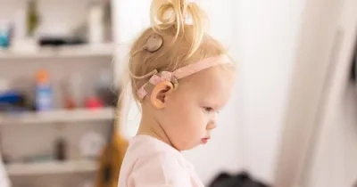 niña con implante coclear de la clínica de navarra