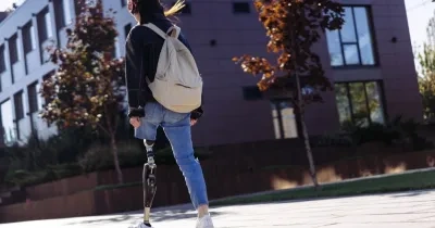 Mujer joven con una amputación caminando por un campus universitario