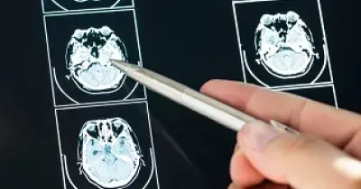 Una exploración médica del cerebro (Fuente: Freepik)