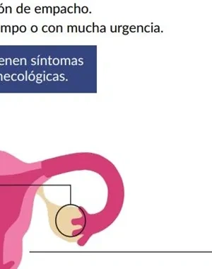 Gráfico de la Guía sobre cáncer ginecológico