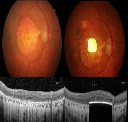 aparece el ojo por dentro y un chip implantado en él.