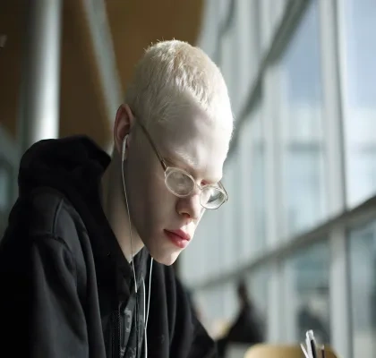 Joven estudiante con albinismo y gafas para corrección de la vista