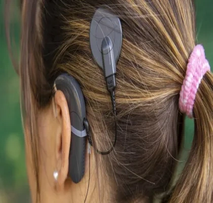 Una mujer con audífono de implante coclear