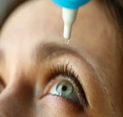 Una persona que sufre el síndrome de ojo seco utilizando lágrimas artificiales (Fuente: Clínica Baviera)