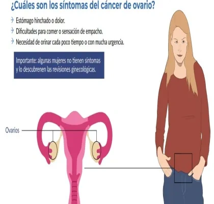 Gráfico de la Guía sobre cáncer ginecológico
