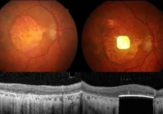 aparece el ojo por dentro y un chip implantado en él.