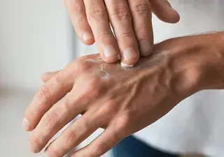 Una persona utilizando una crema especial para el cuidado de la piel durante un proceso de tratamiento oncológico (Fuente: Kernpharma Pacientes)