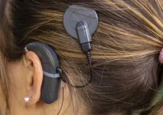Una mujer con audífono de implante coclear