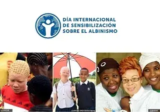 Banner del Día Internacional de Sensibilización sobre el Albinismo 2023 (Fuente: Oficina del Alto Comisionado de las Naciones Unidas para los Derechos Humanos - ACNUDH)