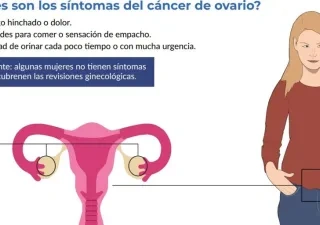 Gráfico de la Guía sobre cáncer ginecológico